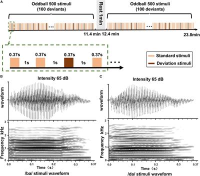 Neural Mechanisms of Hearing Recovery for Cochlear-Implanted Patients: An Electroencephalogram Follow-Up Study